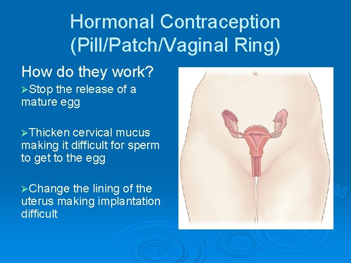 Hormonal Contraception (Pill/Patch/Vaginal Ring) How do they work? ØStop the release of a mature