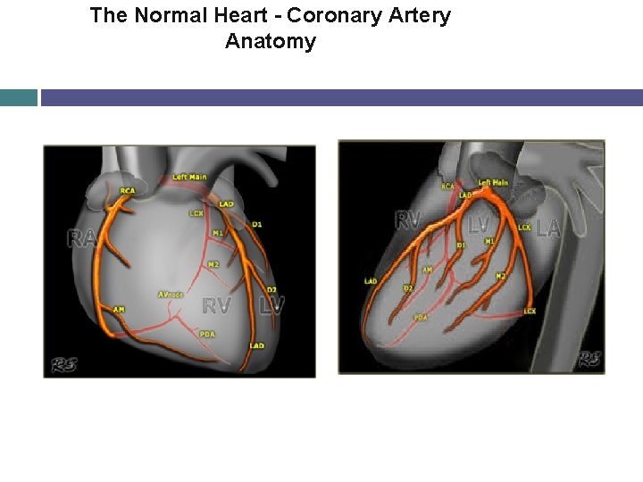 The Normal Heart - Coronary Artery Anatomy 