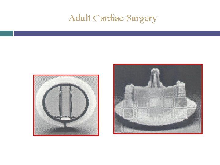 Adult Cardiac Surgery 
