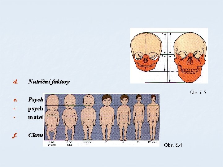 d. Nutriční faktory Obr. č. 5 e. - Psychologické faktory psychosociální nanismus mateřská deprivace