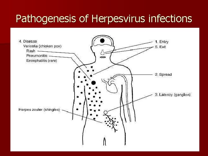 Pathogenesis of Herpesvirus infections 