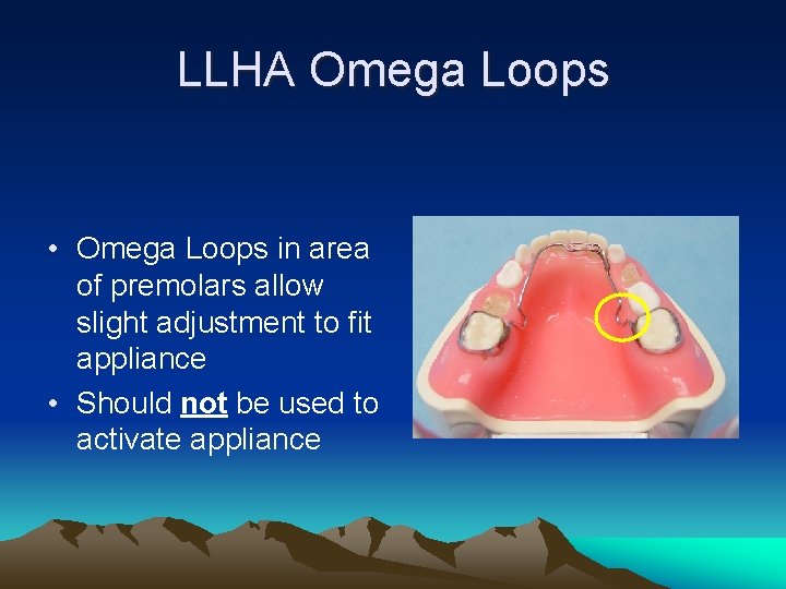LLHA Omega Loops • Omega Loops in area of premolars allow slight adjustment to