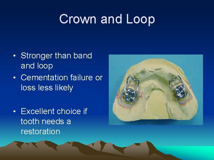Crown and Loop • Stronger than band loop • Cementation failure or loss less