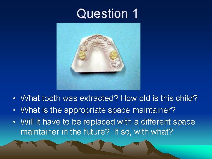 Question 1 • What tooth was extracted? How old is this child? • What