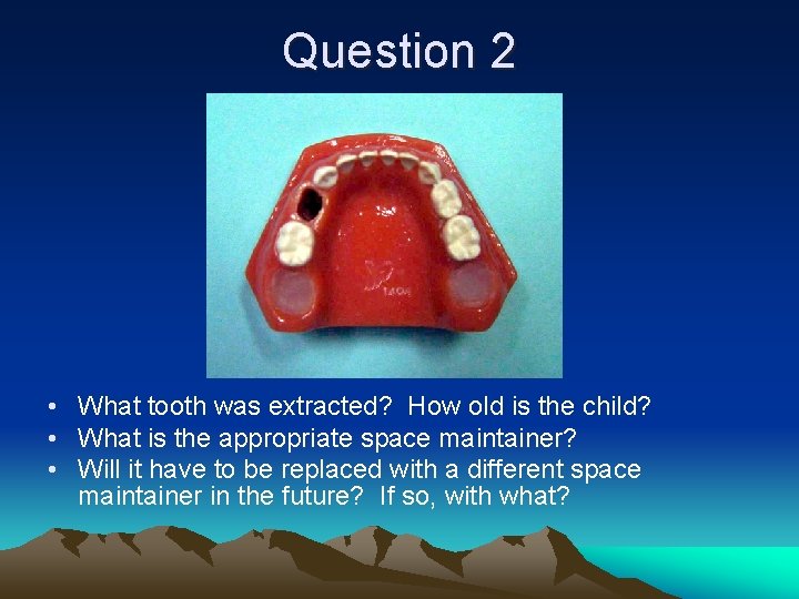 Question 2 • What tooth was extracted? How old is the child? • What