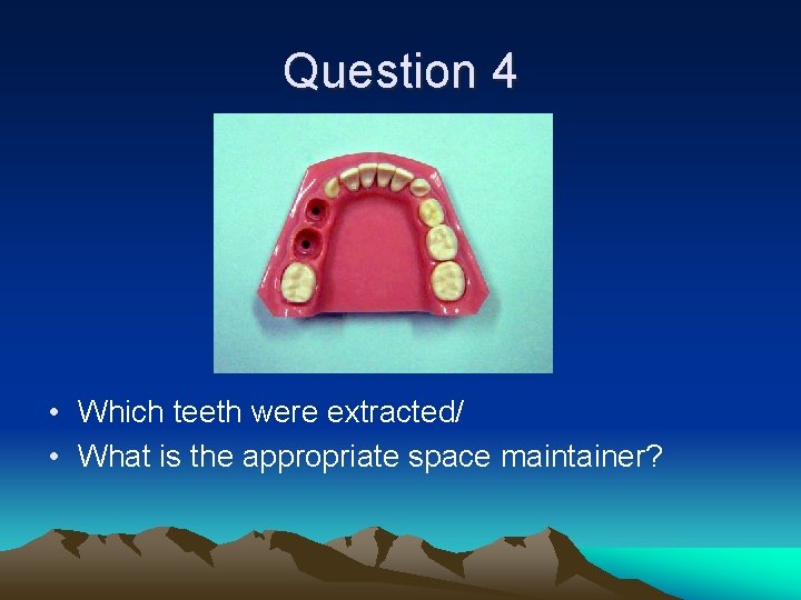 Question 4 • Which teeth were extracted/ • What is the appropriate space maintainer?