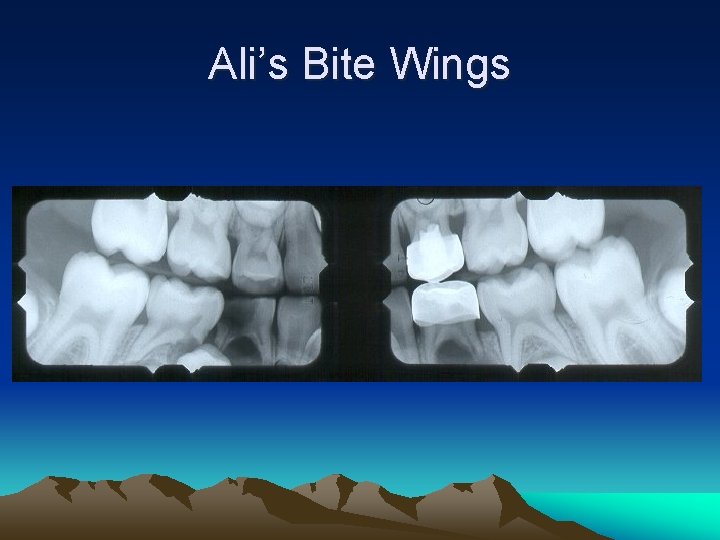 Ali’s Bite Wings 