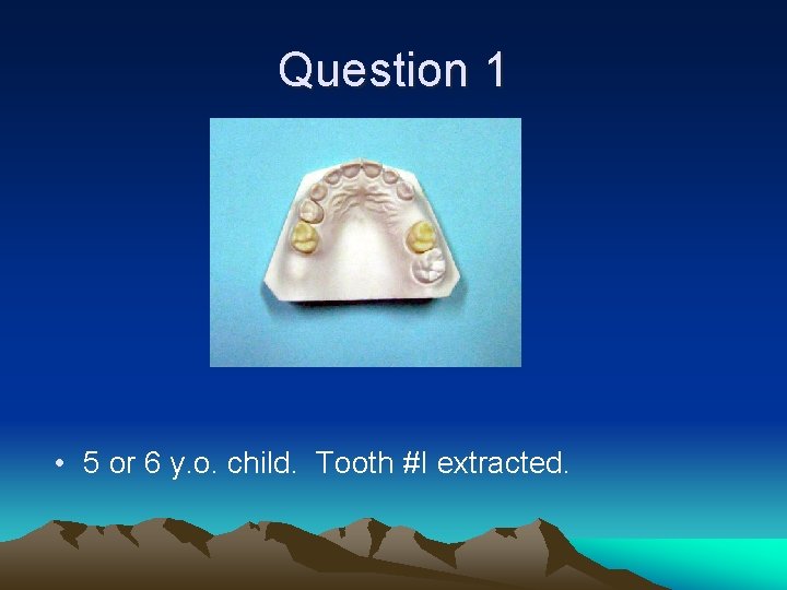Question 1 • 5 or 6 y. o. child. Tooth #I extracted. 
