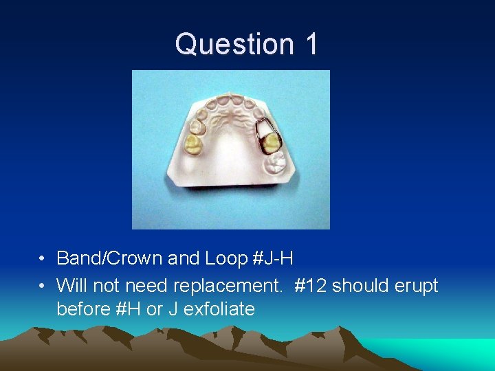 Question 1 • Band/Crown and Loop #J-H • Will not need replacement. #12 should