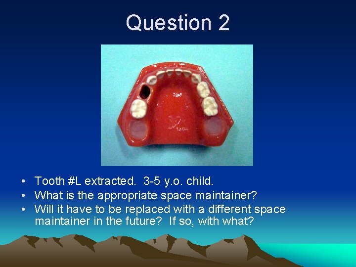 Question 2 • Tooth #L extracted. 3 -5 y. o. child. • What is
