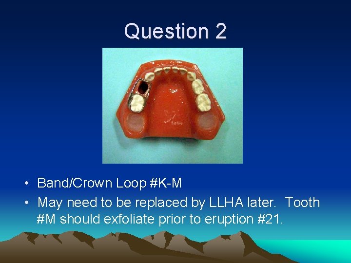 Question 2 • Band/Crown Loop #K-M • May need to be replaced by LLHA