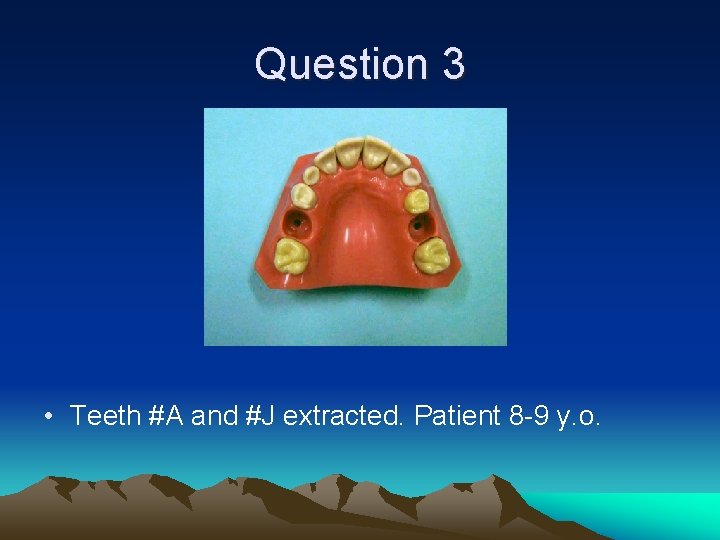 Question 3 • Teeth #A and #J extracted. Patient 8 -9 y. o. 