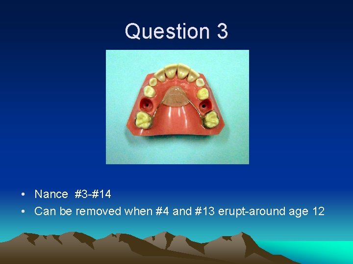 Question 3 • Nance #3 -#14 • Can be removed when #4 and #13