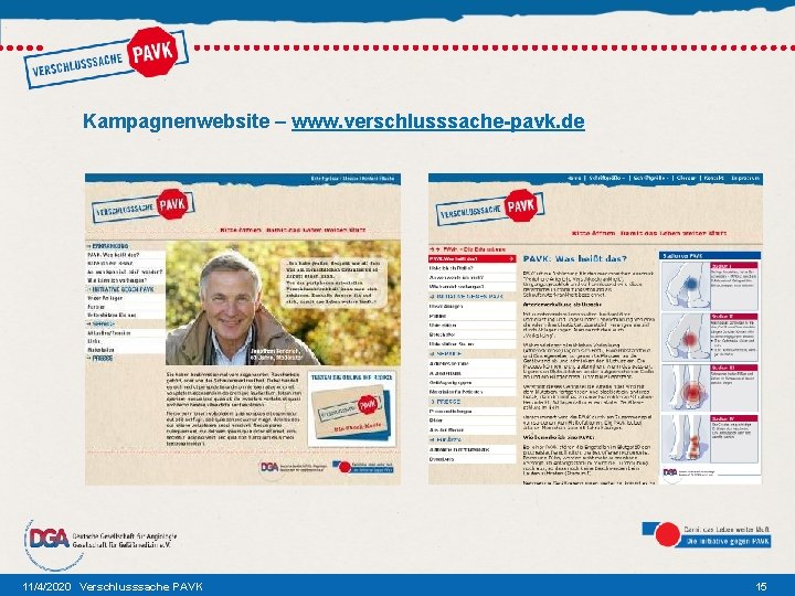 Kampagnenwebsite – www. verschlusssache-pavk. de 11/4/2020 Verschlusssache PAVK 15 