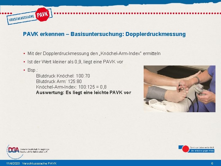 PAVK erkennen – Basisuntersuchung: Dopplerdruckmessung • Mit der Dopplerdruckmessung den „Knöchel-Arm-Index“ ermitteln • Ist