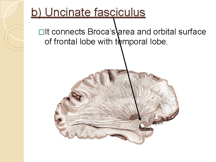 b) Uncinate fasciculus �It connects Broca’s area and orbital surface of frontal lobe with