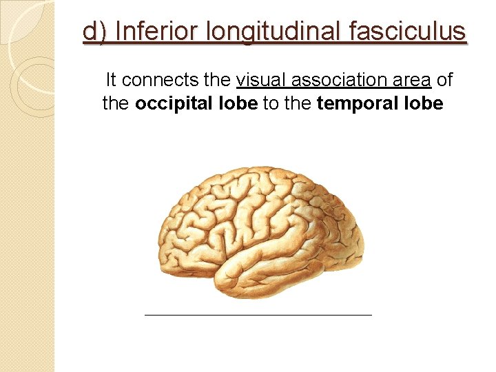 d) Inferior longitudinal fasciculus It connects the visual association area of the occipital lobe