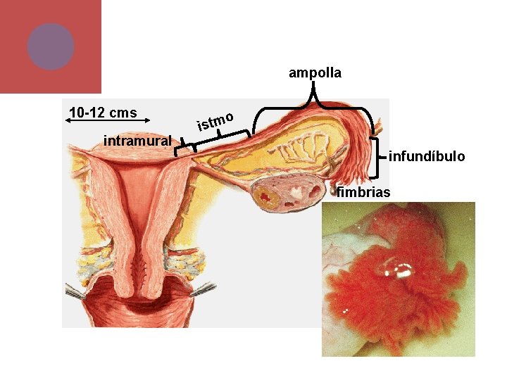 ampolla 10 -12 cms intramural o istm infundíbulo fimbrias 