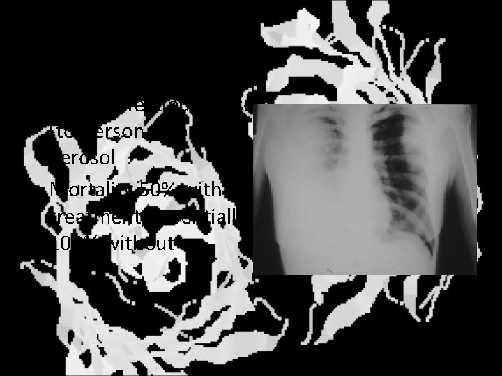 Pneumonic plague • Highly infectious person -to-person through aerosol • Mortality 50% with treatment,