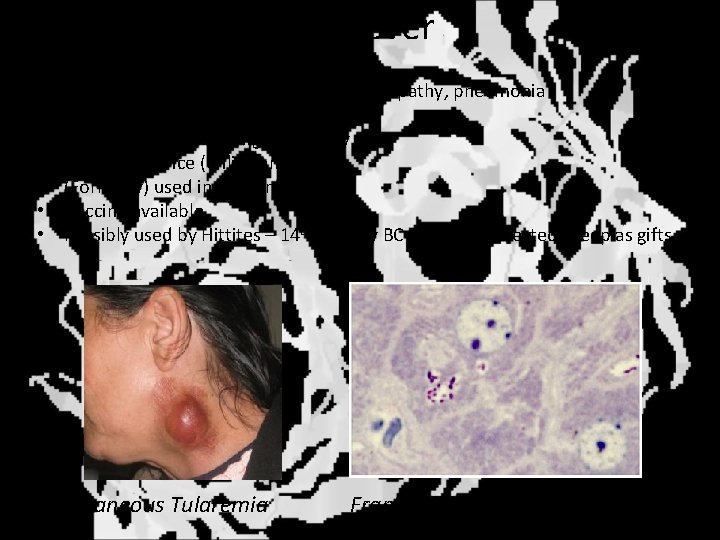 Tularemia – rabbit fever • • Francisella tularensis – gram negative Fever, localized skin