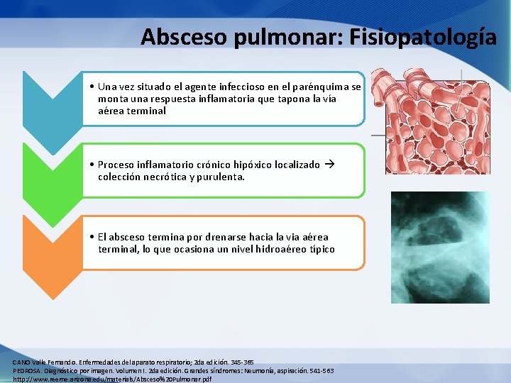 Absceso pulmonar: Fisiopatología • Una vez situado el agente infeccioso en el parénquima se