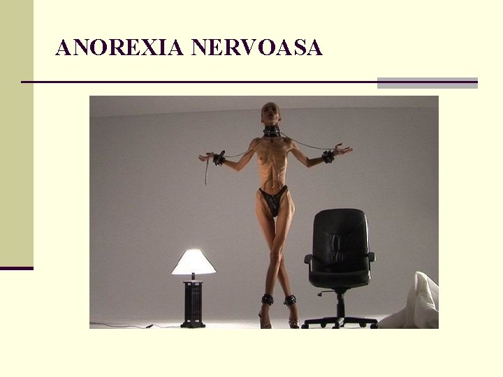ANOREXIA NERVOASA ANOREXIA NERVOASA