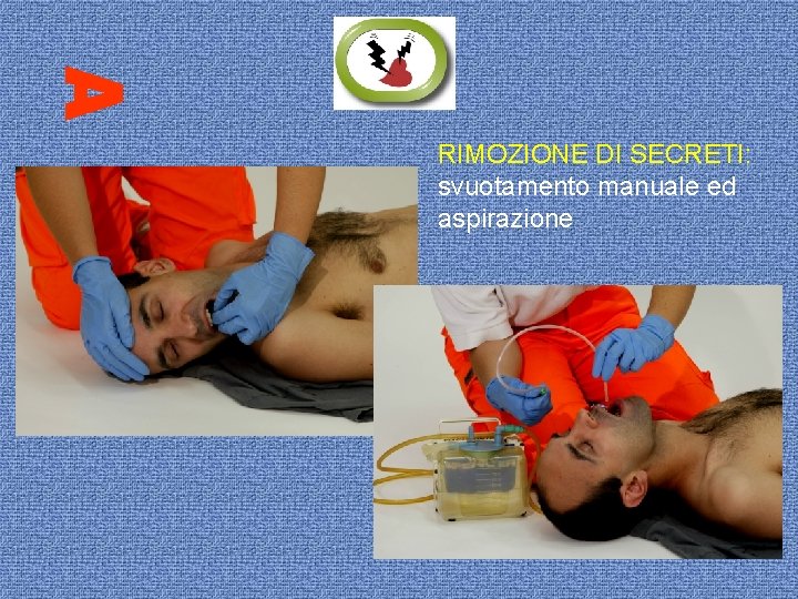 RIMOZIONE DI SECRETI: svuotamento manuale ed aspirazione 