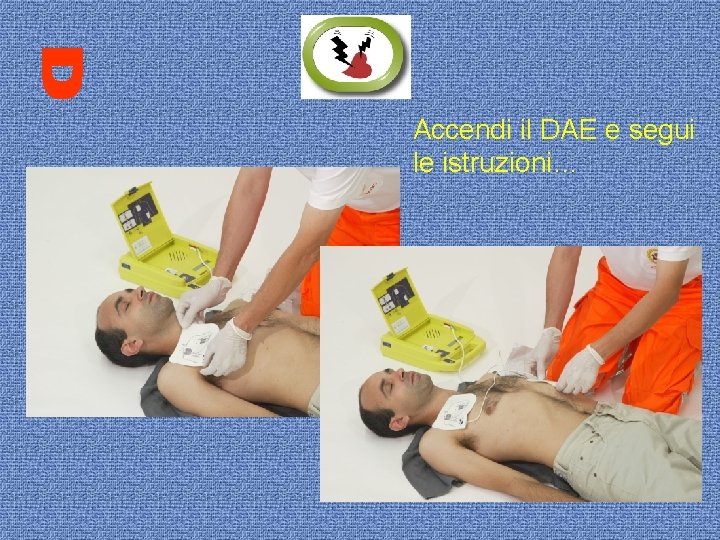 Accendi il DAE e segui le istruzioni… 