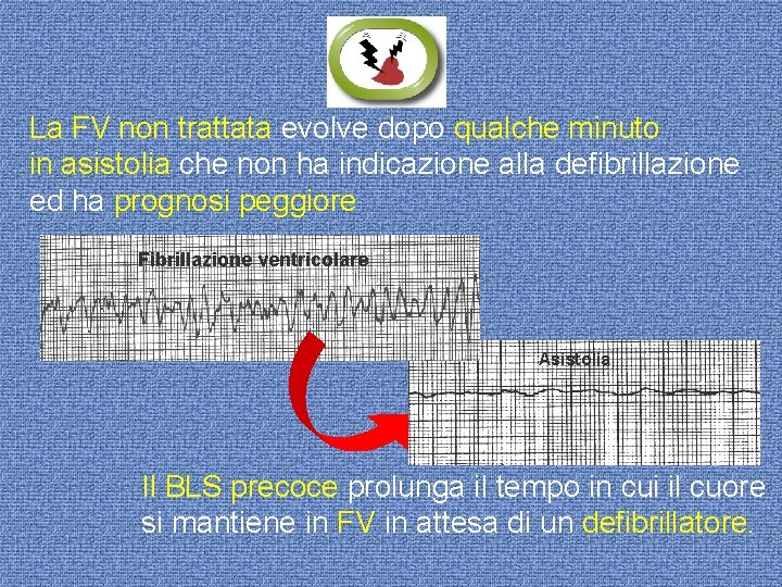 La FV non trattata evolve dopo qualche minuto in asistolia che non ha indicazione