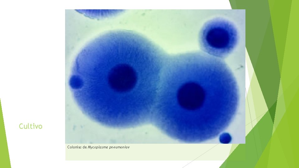 Cultivo Colonias de Mycoplasma pneumoniae 