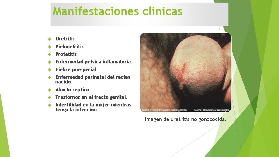 Manifestaciones clinicas Uretritis Pielonefritis Protatitis Enfermedad pelvica inflamatoria. Fiebre puerperial. Enfermedad perinatal del recien