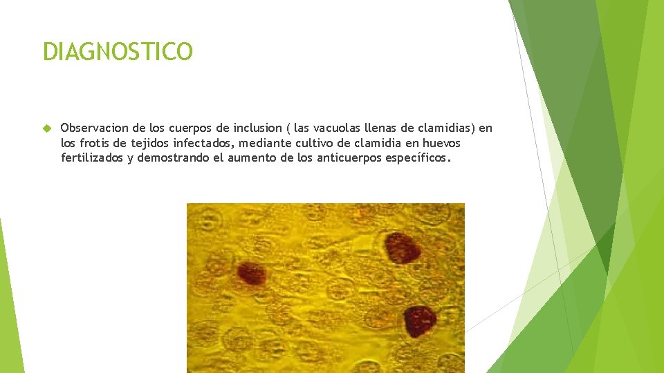 DIAGNOSTICO Observacion de los cuerpos de inclusion ( las vacuolas llenas de clamidias) en