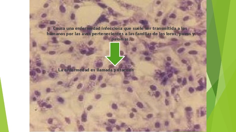 Causa una enfermedad infecciosa que suele ser transmitida a los humanos por las aves