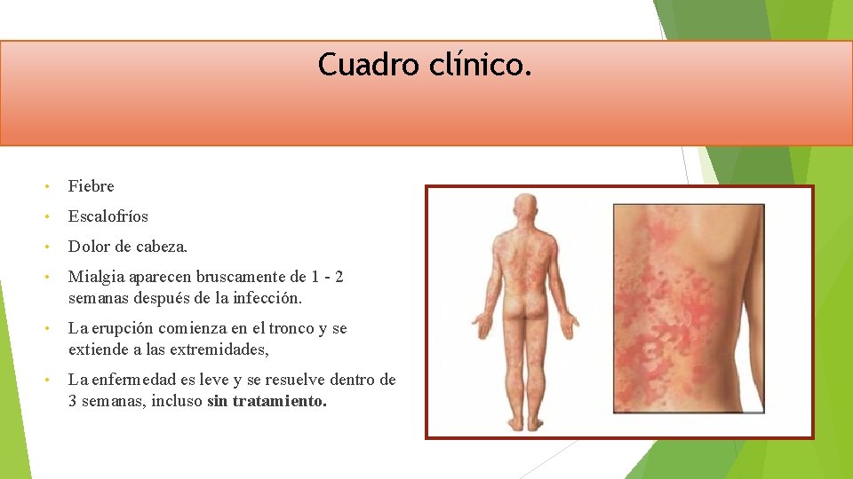 Cuadro clínico. • Fiebre • Escalofríos • Dolor de cabeza. • Mialgia aparecen bruscamente