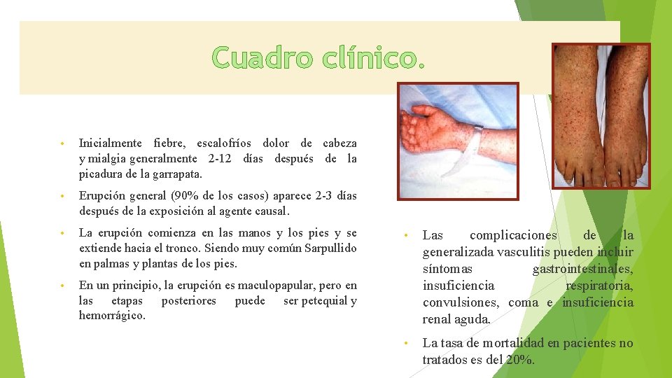 Cuadro clínico. • Inicialmente fiebre, escalofríos dolor de cabeza y mialgia generalmente 2 -12