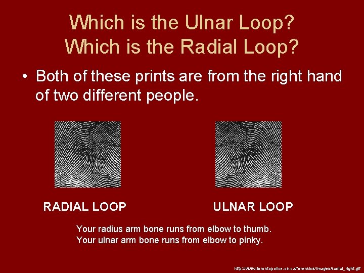 Which is the Ulnar Loop? Which is the Radial Loop? • Both of these