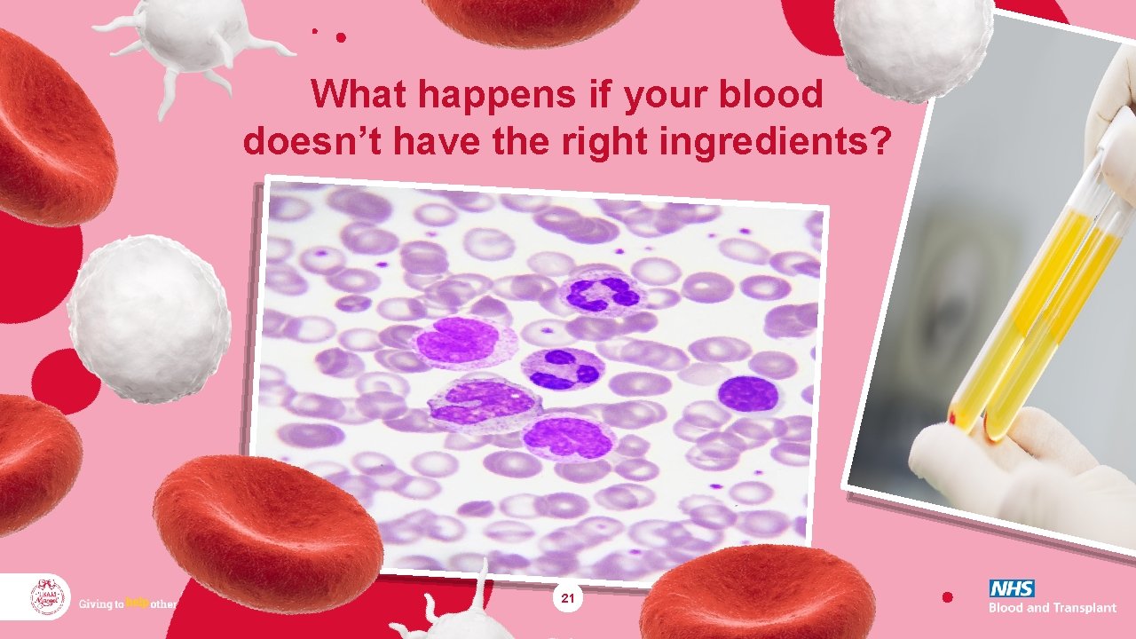 What happens if your blood doesn’t have the right ingredients? 21 