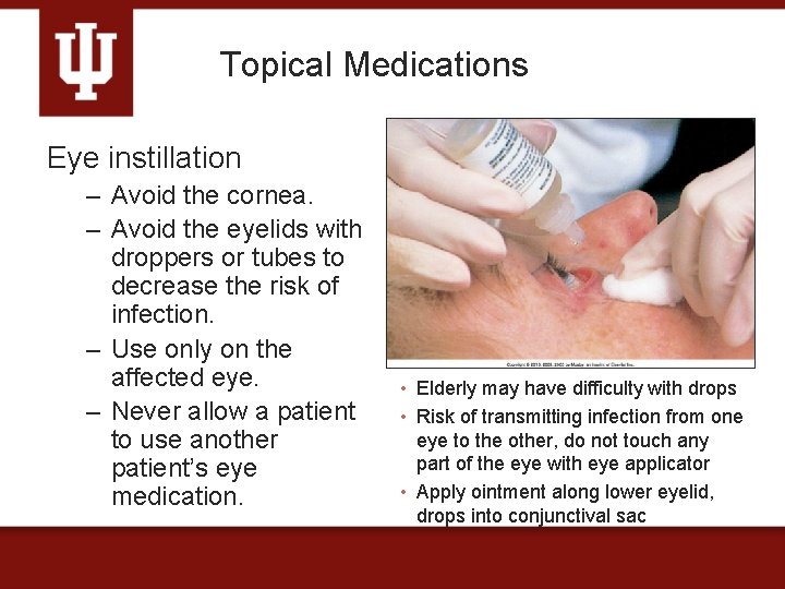 Topical Medications Eye instillation – Avoid the cornea. – Avoid the eyelids with droppers