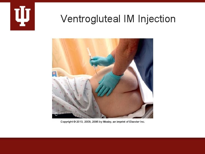 Ventrogluteal IM Injection 