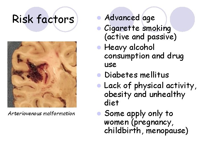 Risk factors l l l Arteriovenous malformation l Advanced age Cigarette smoking (active and