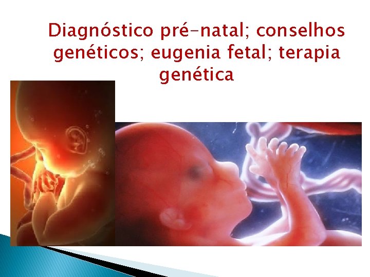 Diagnóstico pré-natal; conselhos genéticos; eugenia fetal; terapia genética 