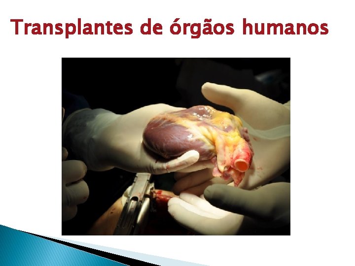 Transplantes de órgãos humanos 