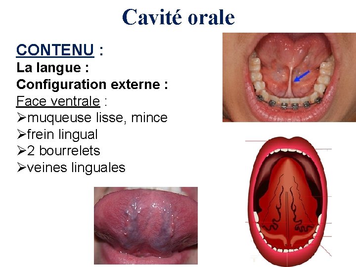 Cavité orale CONTENU : La langue : Configuration externe : Face ventrale : Ømuqueuse