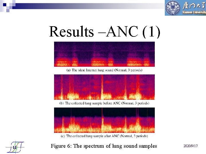 Results –ANC (1) 11 Figure 6: The spectrum of lung sound samples 2020/9/17 