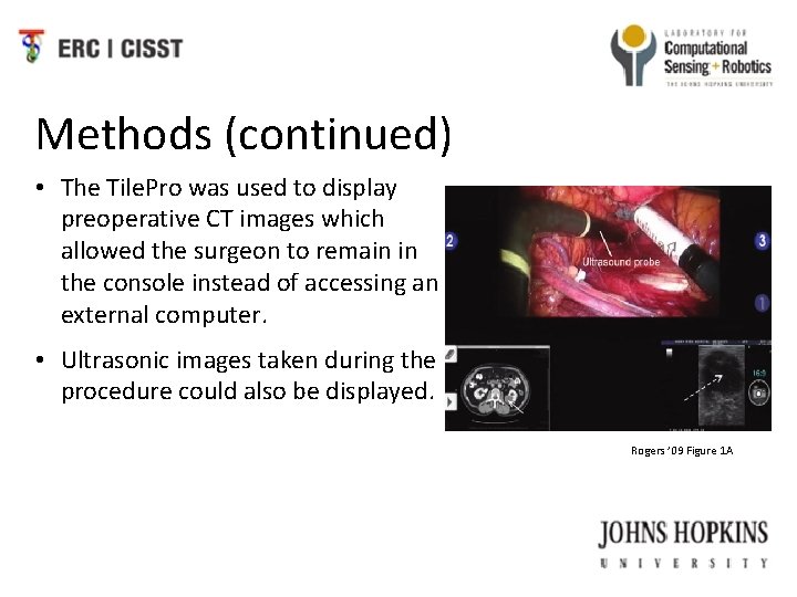 Methods (continued) • The Tile. Pro was used to display preoperative CT images which