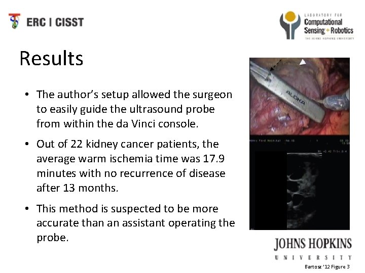 Results • The author’s setup allowed the surgeon to easily guide the ultrasound probe