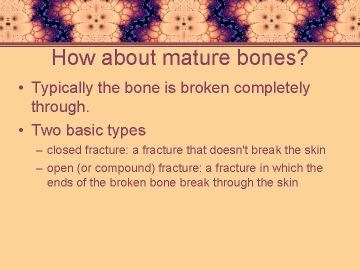 Broken Bones A few common types Is it
