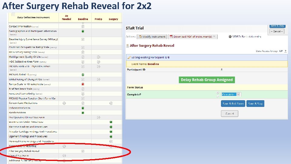 After Surgery Rehab Reveal for 2 x 2 