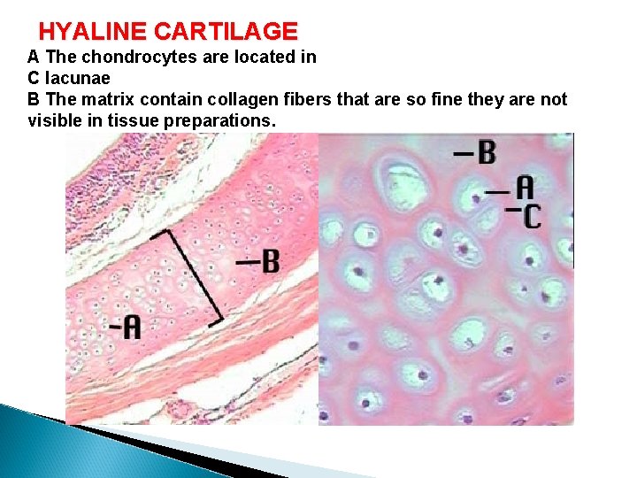  HYALINE CARTILAGE A The chondrocytes are located in C lacunae B The matrix