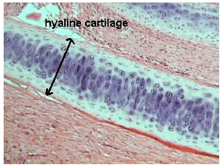 Hyaline cartilage 